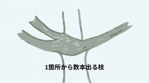 車枝